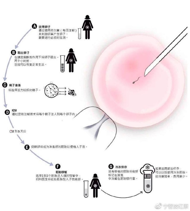 新生儿宝宝打嗝怎么办
