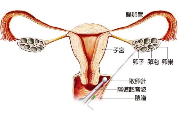 新生儿护理