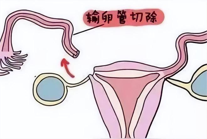 新生儿