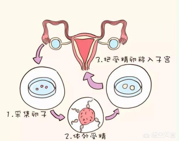 新生儿